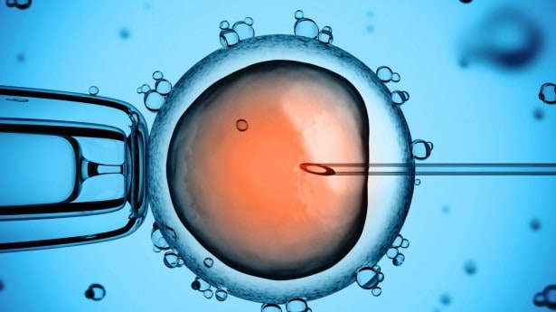 IVF-image
