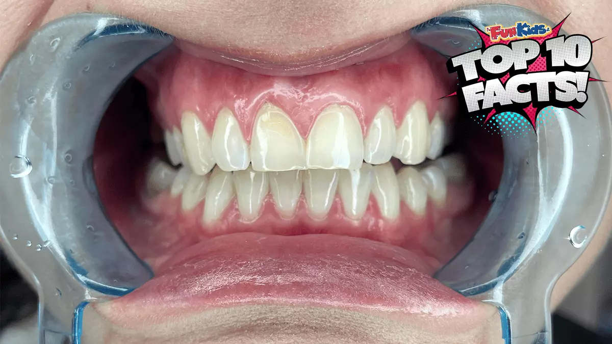 Top 10 Facts About Teeth!